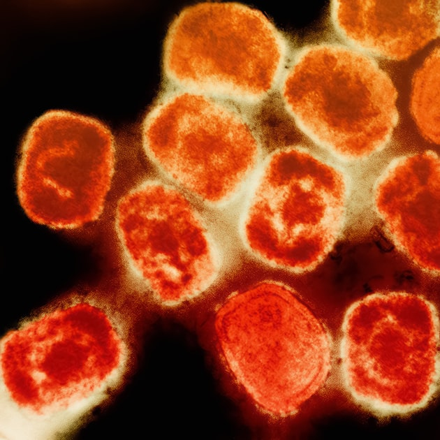 Innovations in Infection Biology